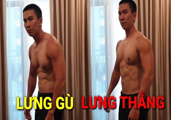 Lưng tôm ảnh hưởng đến thẩm mỹ