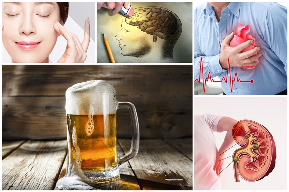 1 lon bia bao nhiêu calo? Uống bao nhiêu đảm bảo sức khỏe? 4 Uống bia quá nhiều có tác hại như thế nào?
