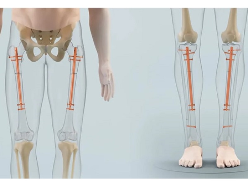 27 tuổi còn tăng chiều cao được không? Cách tăng chiều cao 5 27 tuổi còn tăng chiều cao được không