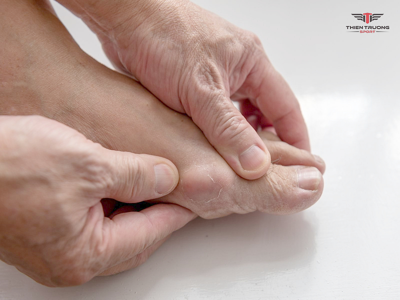 Bệnh gout là gì? Nguyên nhân dẫn tới bệnh gout 5 biến chứng bệnh gout