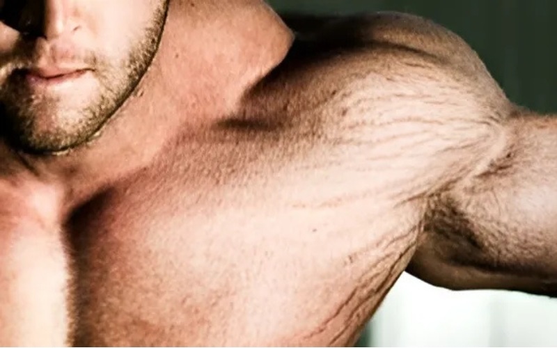 Rạn da khi tập thể hình: Nguyên nhân, ảnh hưởng, cách khắc phục 2 rạn da khi tập thể hình