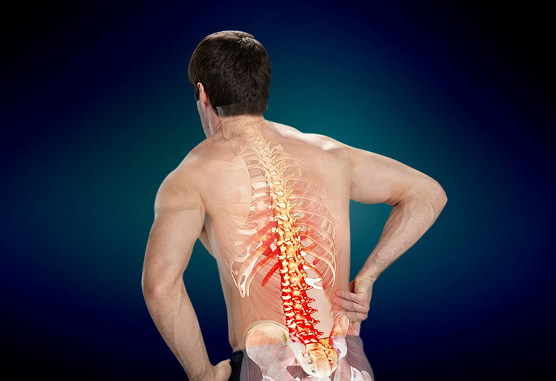 Thoát vị đĩa đệm 