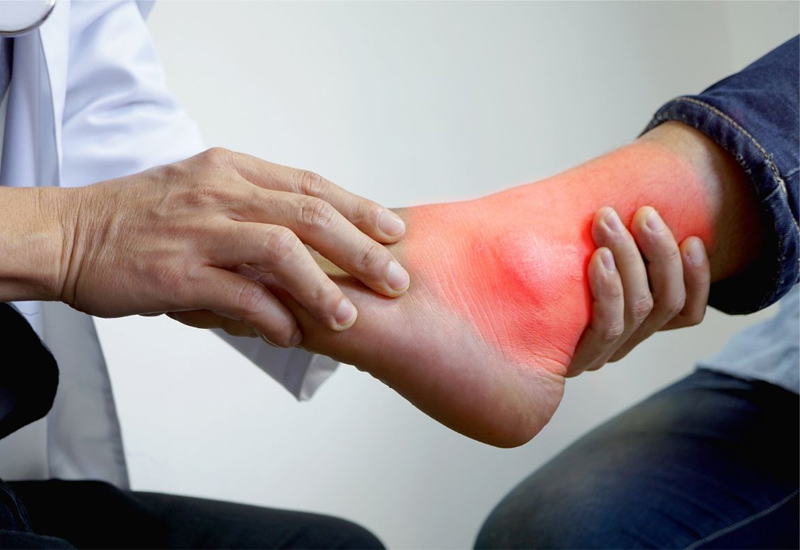 Bài tập cho gout ở cổ chân