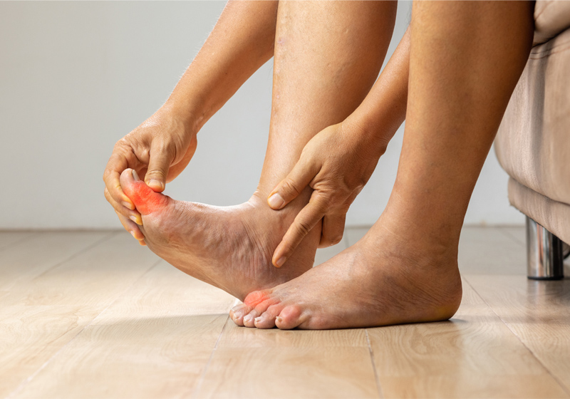 Bài tập cho gout ở ngón chân và bàn chân